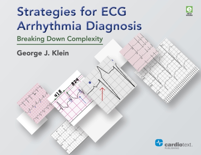 Strategies for ECG Arrhythmia Diagnosis : Breaking Down Complexity, PDF eBook