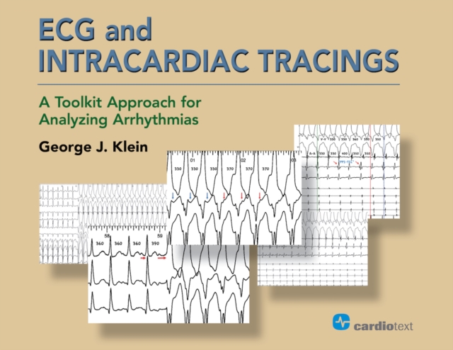 ECG and Intracardiac Tracings : A Toolkit Approach for Analyzing Arrhythmias, PDF eBook