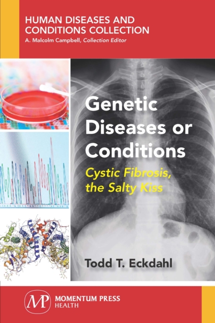 Genetic Diseases or Conditions : Cystic Fibrosis, The Salty Kiss, Paperback / softback Book