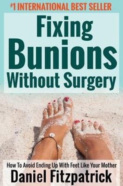 Fixing Bunions Without Surgery : How to Avoid Ending Up with Feet Like Your Mother, Paperback / softback Book