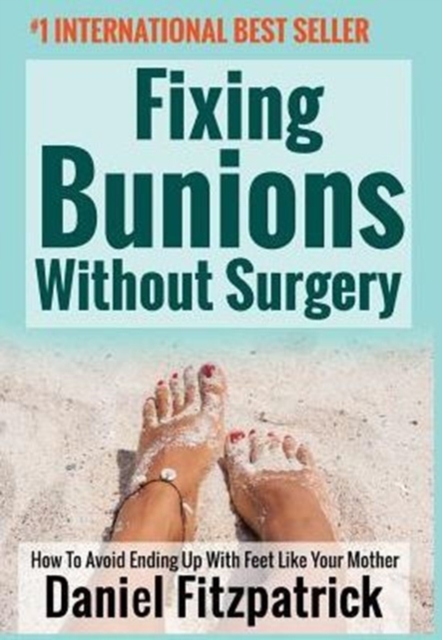 Fixing Bunions Without Surgery : How to Avoid Ending Up with Feet Like Your Mother, Hardback Book
