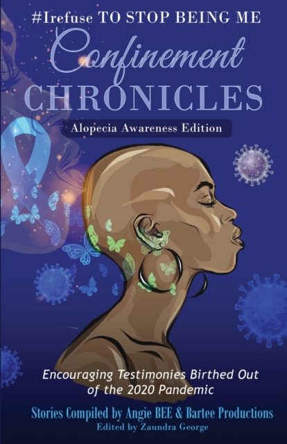 #Irefuse to Stop Being Me : Confinement Chronicles - Alopecia Awareness Edition, Paperback / softback Book