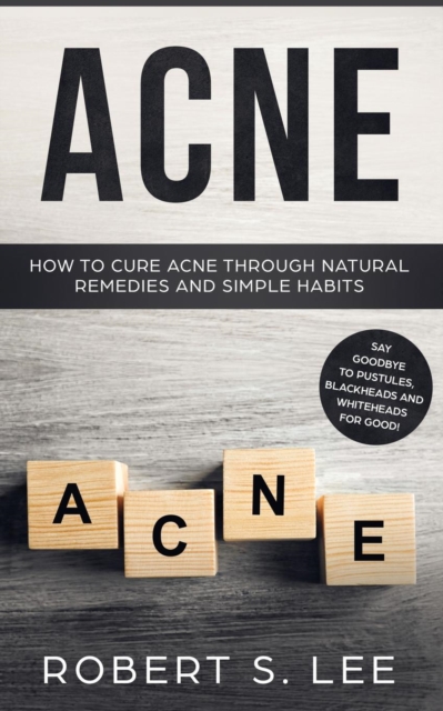 Acne : How to Cure Acne through Natural Remedies and Simple Habits. Say Goodbye to Pustules, Blackheads and Whiteheads for Good!, Paperback / softback Book