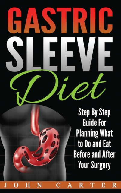 Gastric Sleeve Diet : Step By Step Guide For Planning What to Do and Eat Before and After Your Surgery, Hardback Book