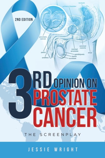 3rd Opinion on Prostate Cancer : The Screenplay, Paperback / softback Book