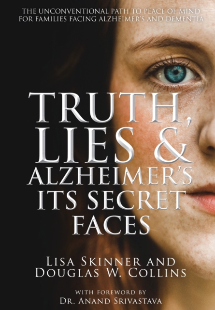 Truth, Lies & Alzheimer's : Its Secret Faces, Hardback Book
