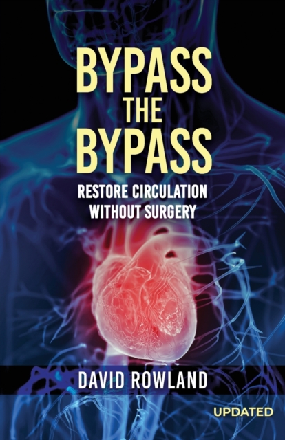 Bypass the Bypass : RESTORE CIRCULATION WITHOUT SURGERY (Revised Edition): RESTORE CIRCULATION WITHOUT SURGERY, Paperback / softback Book