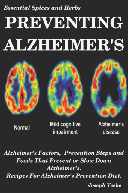 Preventing Alzheimer's : Alzheimer's Factors, Prevention Steps and Foods That Prevent or Slow Alzheimer's, Recipes for Alzheimer's Prevention Diet, Paperback / softback Book