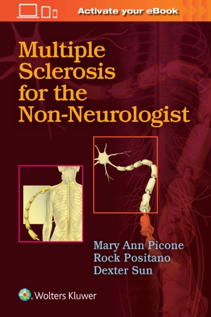 Multiple Sclerosis for the Non-Neurologist, Paperback / softback Book
