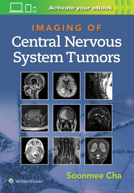 Imaging of Central Nervous System Tumors, Hardback Book