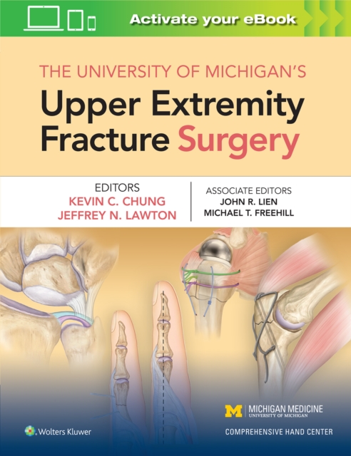The University of Michigan's Upper Extremity Fracture Surgery, Hardback Book