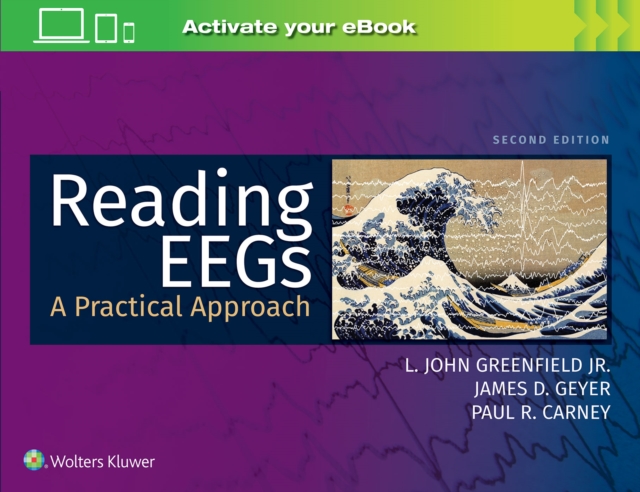 Reading EEGs: A Practical Approach, Paperback / softback Book