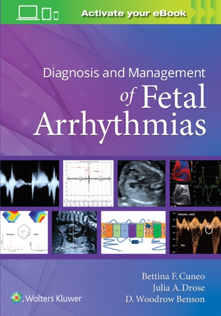 Diagnosis and Management of Fetal Arrhythmias, Paperback / softback Book