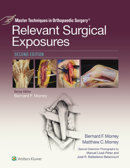 Master Techniques in Orthopaedic Surgery: Relevant Surgical Exposures, EPUB eBook