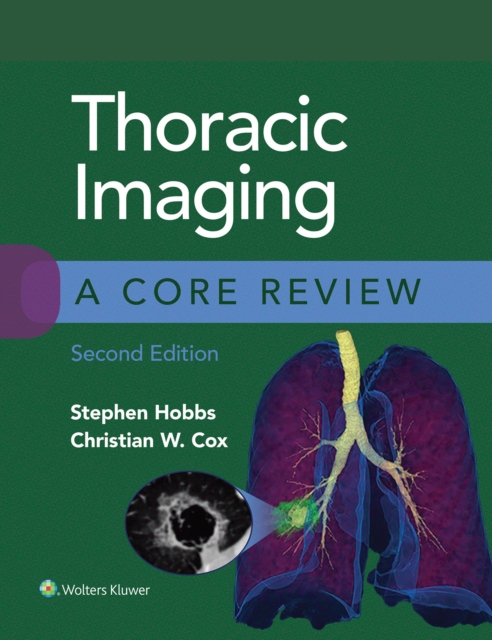 Thoracic Imaging: A Core Review, EPUB eBook