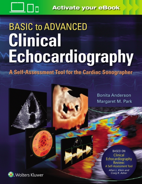 Basic to Advanced Clinical Echocardiography : A Self-Assessment Tool for the Cardiac Sonographer, Paperback / softback Book