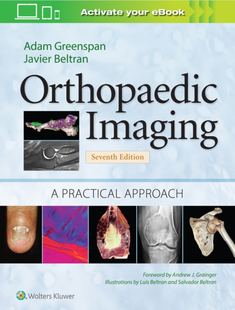 Orthopaedic Imaging: A Practical Approach, Hardback Book
