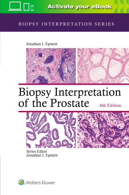 Biopsy Interpretation of the Prostate, Hardback Book