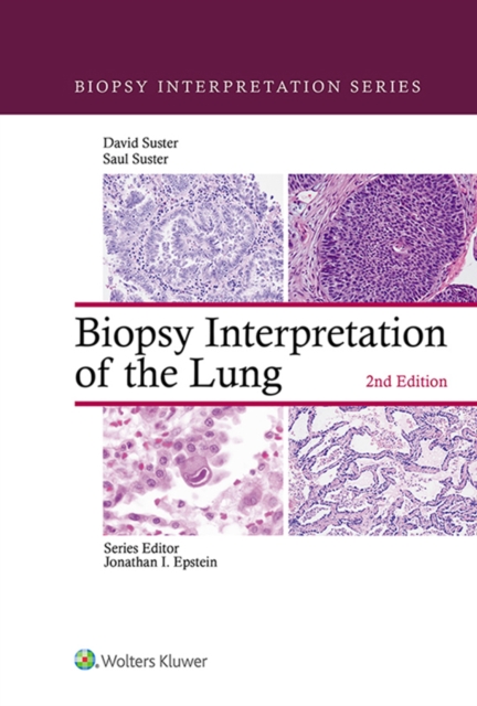 Biopsy Interpretation of the Lung, EPUB eBook