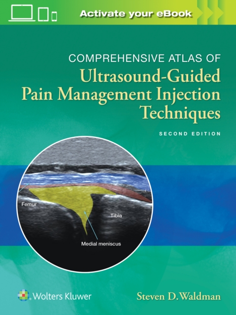 Comprehensive Atlas of Ultrasound-Guided Pain Management Injection Techniques, Hardback Book