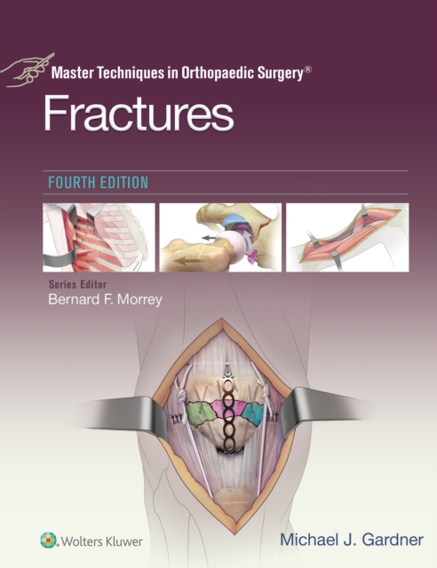 Master Techniques in Orthopaedic Surgery: Fractures, EPUB eBook