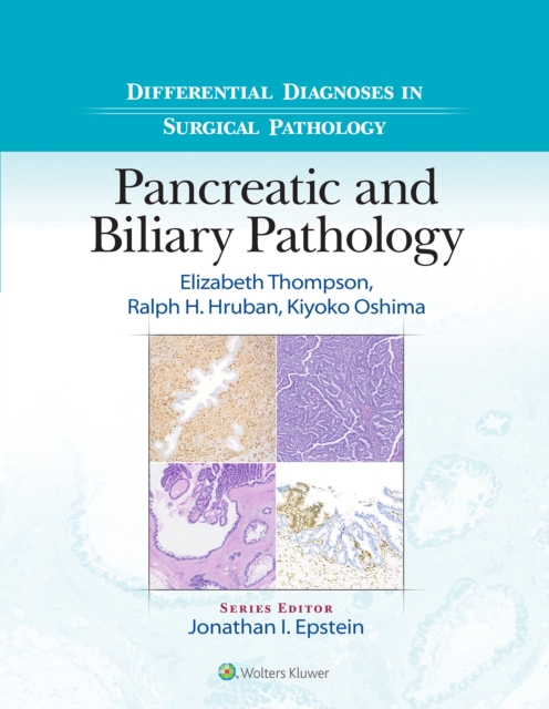 Differential Diagnoses in Surgical Pathology: Pancreatic and Biliary Pathology, EPUB eBook