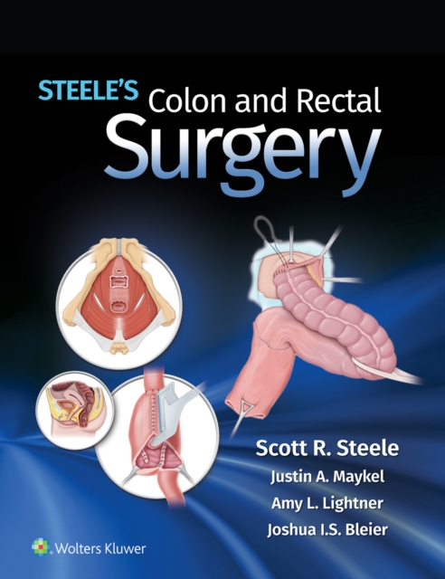 Steele's Colon and Rectal Surgery, EPUB eBook