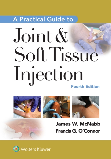 A Practical Guide to Joint & Soft Tissue Injection, EPUB eBook