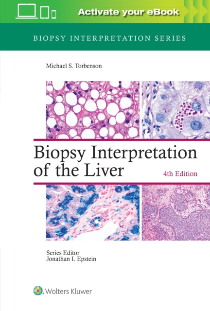 Biopsy Interpretation of the Liver, Hardback Book