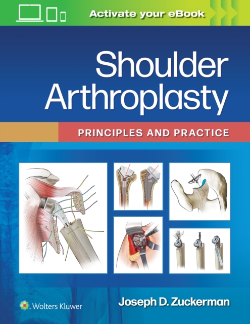 Shoulder Arthroplasty : Principles and Practice, Hardback Book