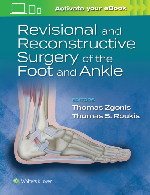 Revisional and Reconstructive Surgery of the Foot and Ankle, Hardback Book