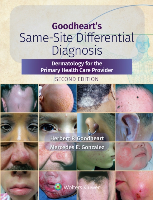 Goodheart's Same-Site Differential Diagnosis : Dermatology for the Primary Health Care Provider, EPUB eBook