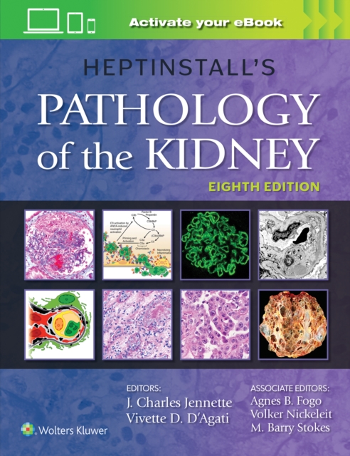 Heptinstall's Pathology of the Kidney, Hardback Book
