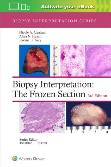 Biopsy Interpretation: The Frozen Section: Print + eBook with Multimedia, Hardback Book