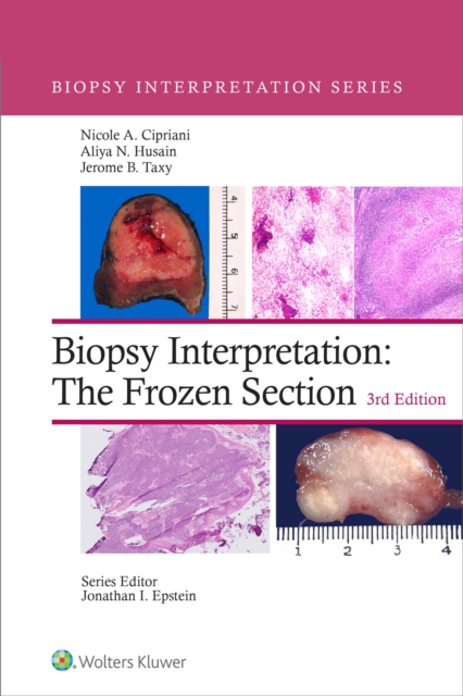 Biopsy Interpretation: The Frozen Section, EPUB eBook