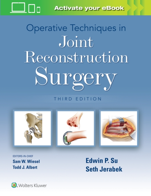 Operative Techniques in Joint Reconstruction Surgery, Hardback Book