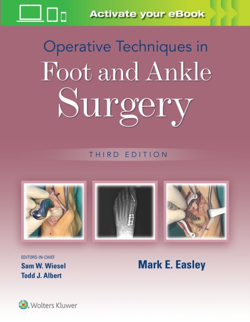 Operative Techniques in Foot and Ankle Surgery, Hardback Book