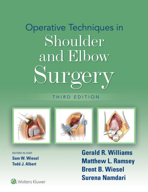 Operative Techniques in Shoulder and Elbow Surgery, EPUB eBook