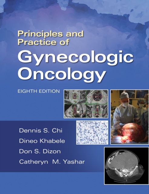 Principles and Practice of Gynecologic Oncology, EPUB eBook