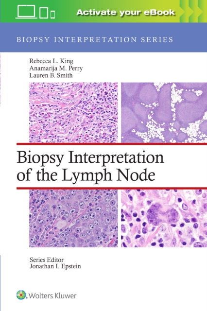 Biopsy Interpretation of the Lymph Node: Print + eBook with Multimedia, Hardback Book