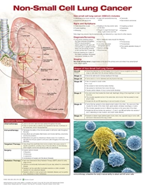 Non-Small Cell Lung Cancer, Chart Laminated, Poster Book