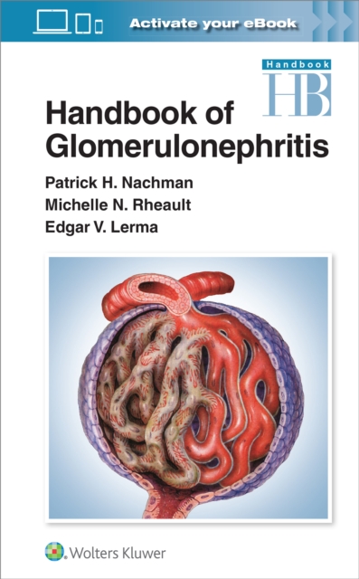 Handbook of Glomerulonephritis, Paperback / softback Book
