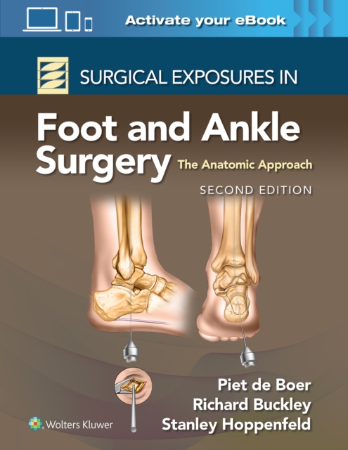 Surgical Exposures in Foot and Ankle Surgery: The Anatomic Approach, Hardback Book