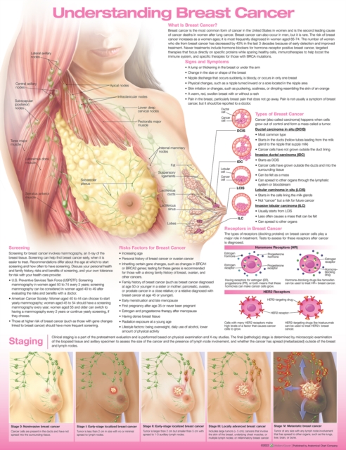 Understanding Breast Cancer Anatomical Chart, Wallchart Book