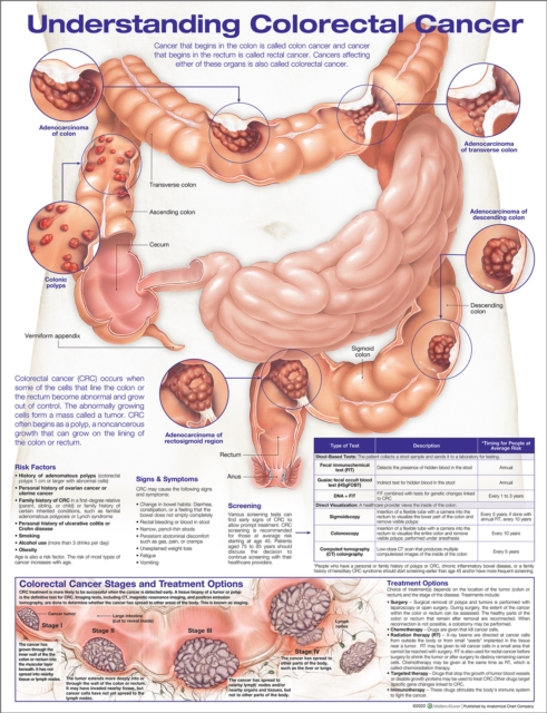 Understanding Colorectal  Cancer Anatomical Chart, Wallchart Book