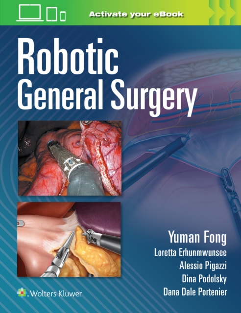 Robotic General Surgery, Hardback Book