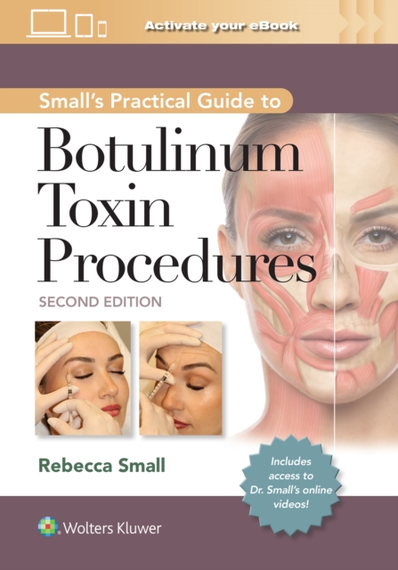 Small's Practical Guide to Botulinum Toxin Procedures, Hardback Book