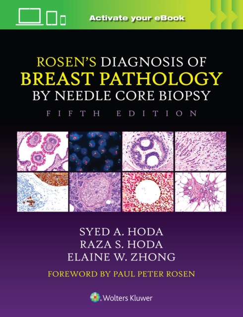 Rosen's Diagnosis of Breast Pathology by Needle Core Biopsy, Hardback Book