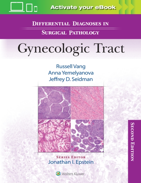 Differential Diagnoses in Surgical Pathology: Gynecologic Tract, Hardback Book