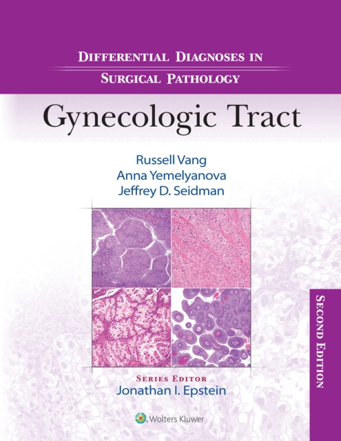 Differential Diagnoses in Surgical Pathology: Gynecologic Tract, EPUB eBook
